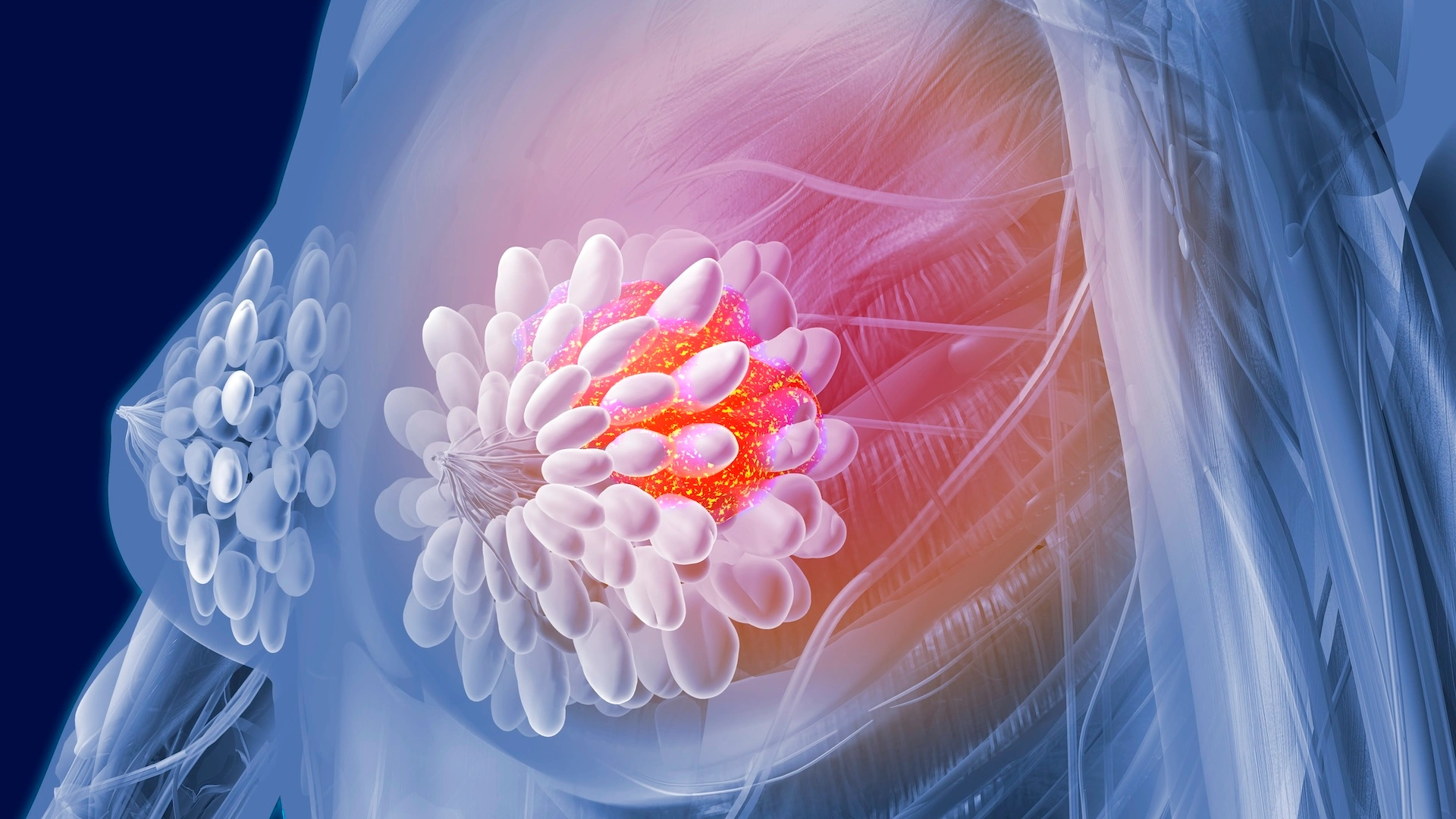 Doctor showing lung scan